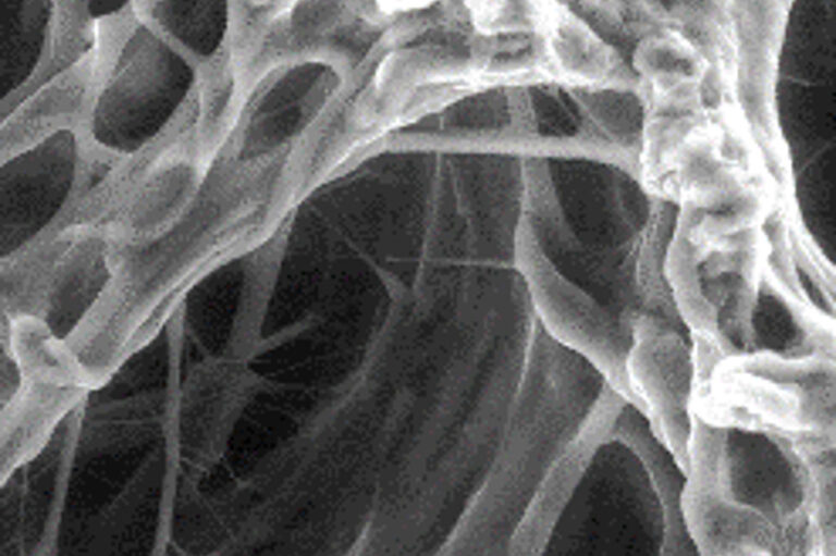Collagen scaffolds for cell & tissue culture